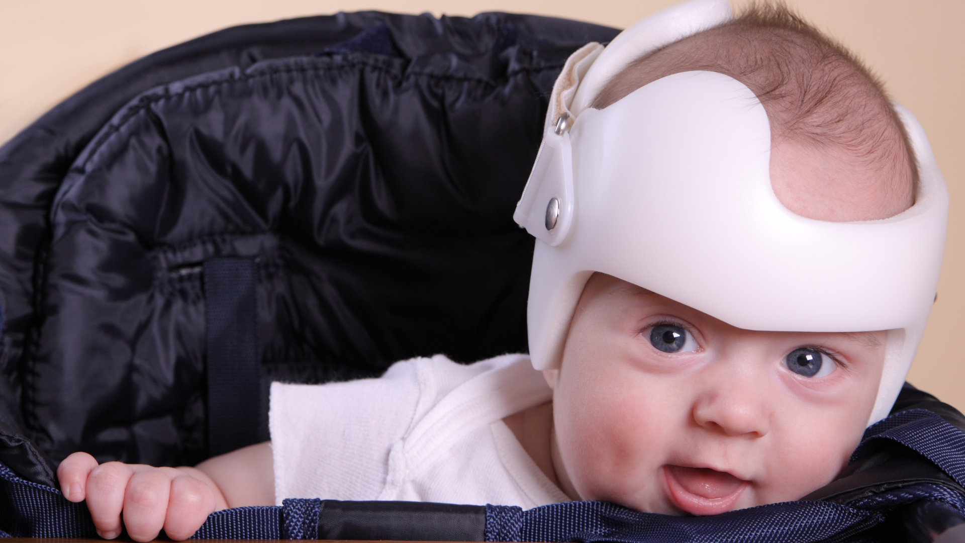 helmet therapy who needs it and when